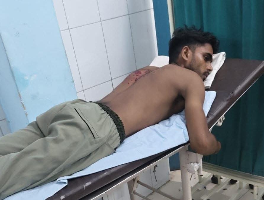 घर लौट रहे युवक पर फायरिंग, पीठ में लगे छर्रे, जांच में जुटी पुलिस