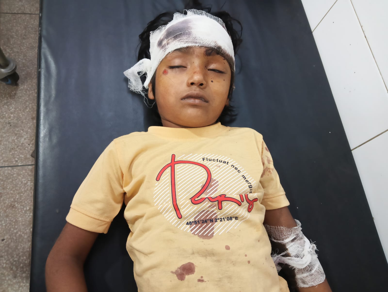 तेज रफ्तार कार की टक्कर से 6 साल की मासूम गंभीर रूप घायल हायर सेंटर रेफर  बुलन्द संदेश/लल्ला सलमानी