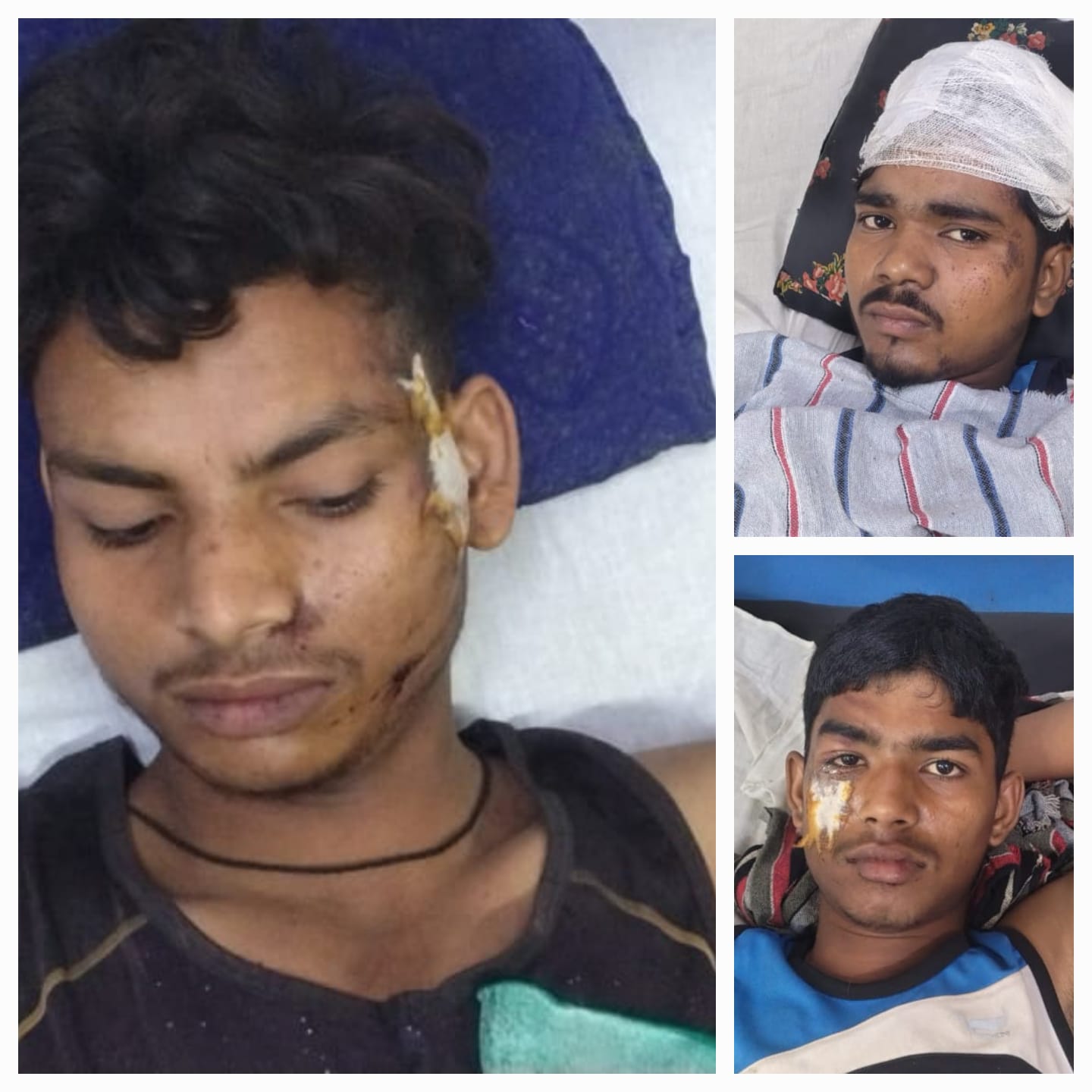 जोगिंग कर रहे तीन युवकों को तेज रफ्तार वाहन ने  रौंदा,एक की हालत नाजुक।