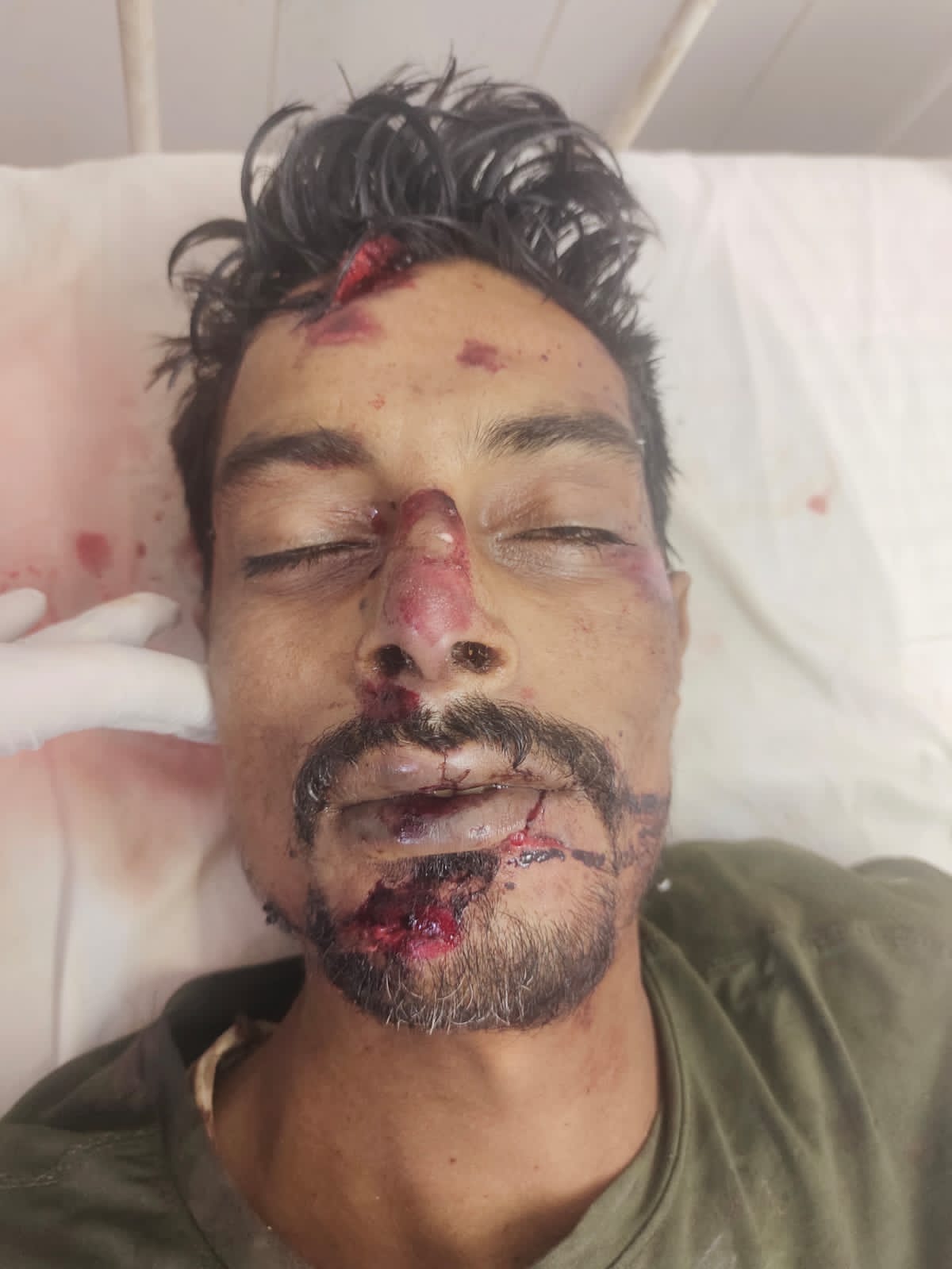 दिल्ली-लखनऊ हाईवे किनारे घायल मिले युवक की अस्पताल में मौत, पहचान में जुटी पुलिस