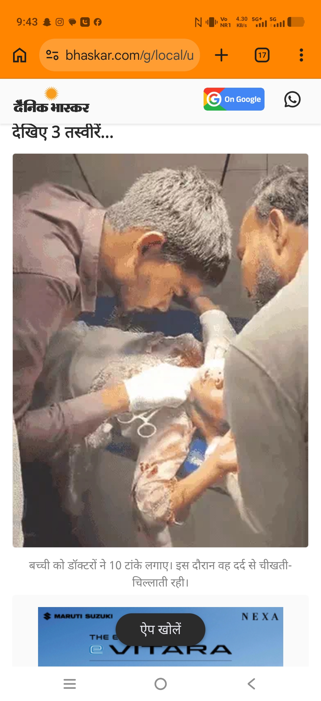 लखनऊ में चाइनीज मांझे का कहर: 6 साल की बच्ची की गर्दन कटी, 10 टांके लगे, 6 पतंगबाज गिरफ्तार