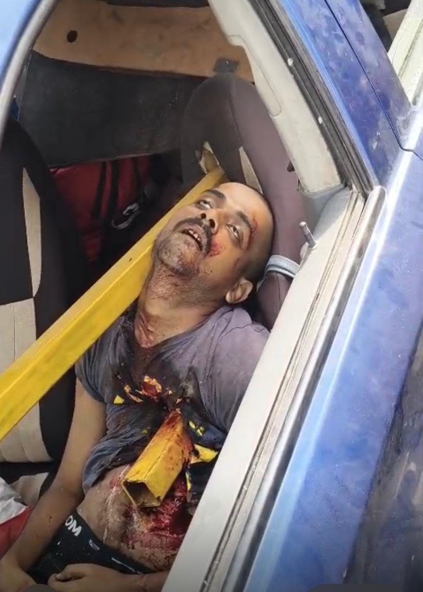 जनपद अमरोहा के गजरौला थाना क्षेत्र में नेशनल हाईवे नंबर -9 पर आज  सुबह साढ़े नो बजे एक सड़क हादसे में चालक को नींद